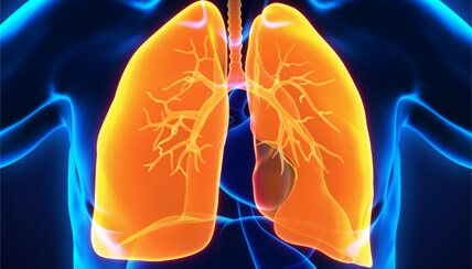 Bronchiectasis Lungs